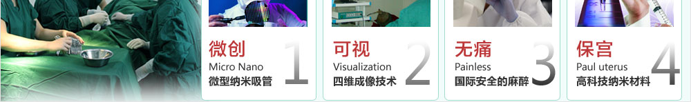 可尔依保宫无痛人流技术4